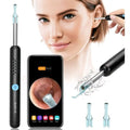 Smart Ear Wax Remover | HD WiFi Camera | 6 LED Lights | iOS & Android App