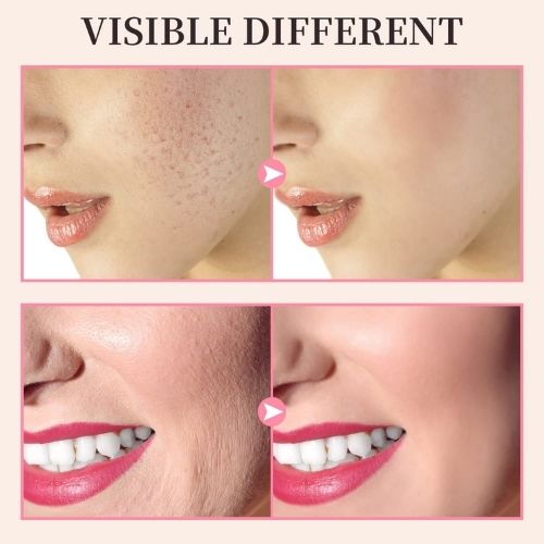 High Frequency Facial Wand | 4-in-1 Electrotherapy Skin & Hair Care Device