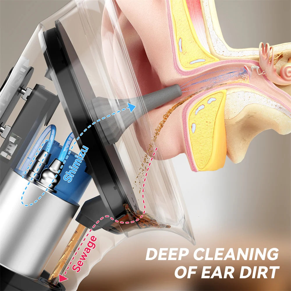 Electric Ear Irrigation Kit | 4 Pressure Levels | IPX7 Waterproof | Safe Ear Wax Removal