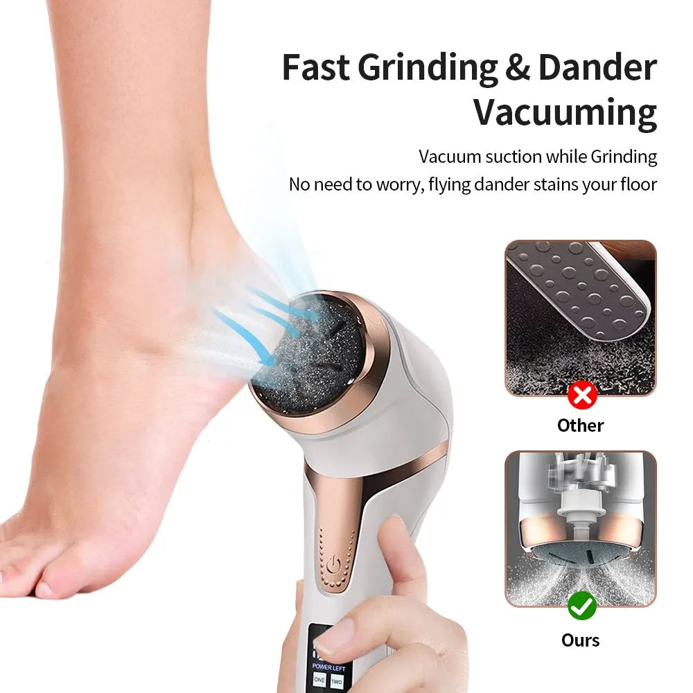Electric Foot Callus Remover – Rechargeable Electronic Foot File | Dead Skin Remover | Salon-Quality Pedicure | 3 Colors