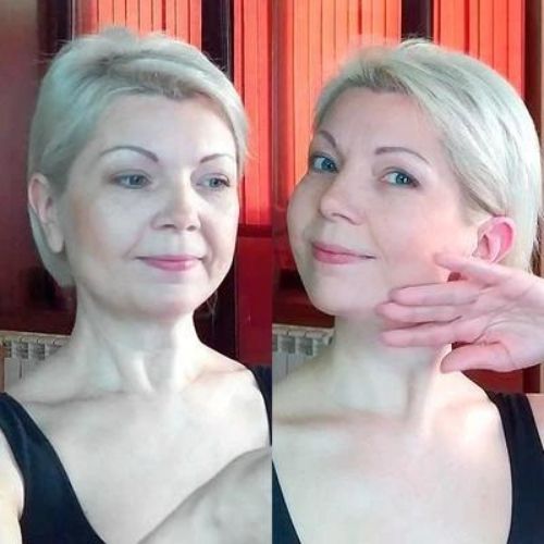 V-Line Face Lifting Chin Mask – Slimming, Firming & Anti-Aging (5 Pack)