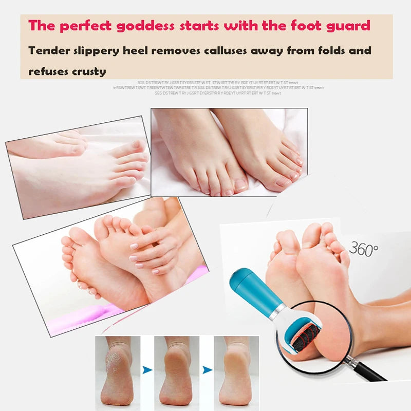 Electric Foot Callus Remover